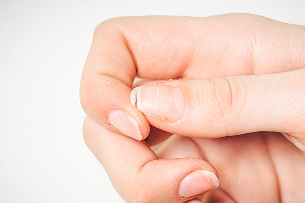 指甲如果脆弱、容易断，好好摄取营养可改善。(Shutterstock)